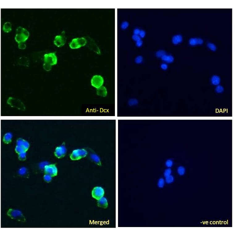 Immunofluorescence - Anti-Doublecortin Antibody (A83041) - Antibodies.com