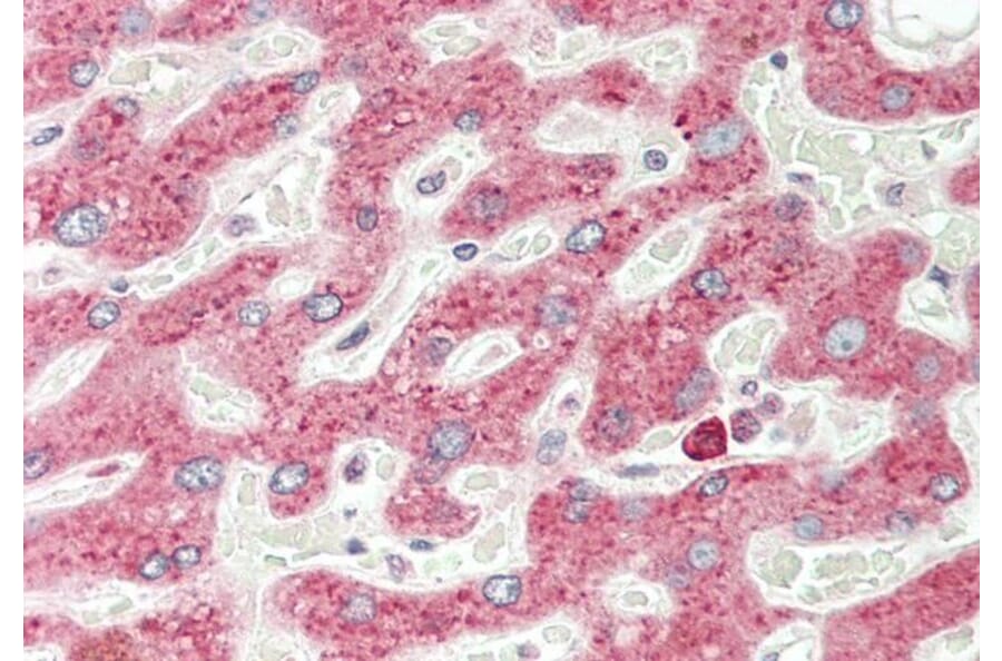 Immunohistochemistry - Anti-VEGFA Antibody (A83043) - Antibodies.com