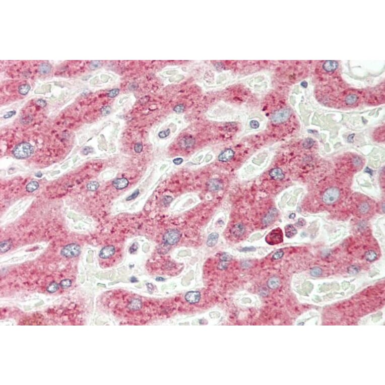 Immunohistochemistry - Anti-VEGFA Antibody (A83043) - Antibodies.com