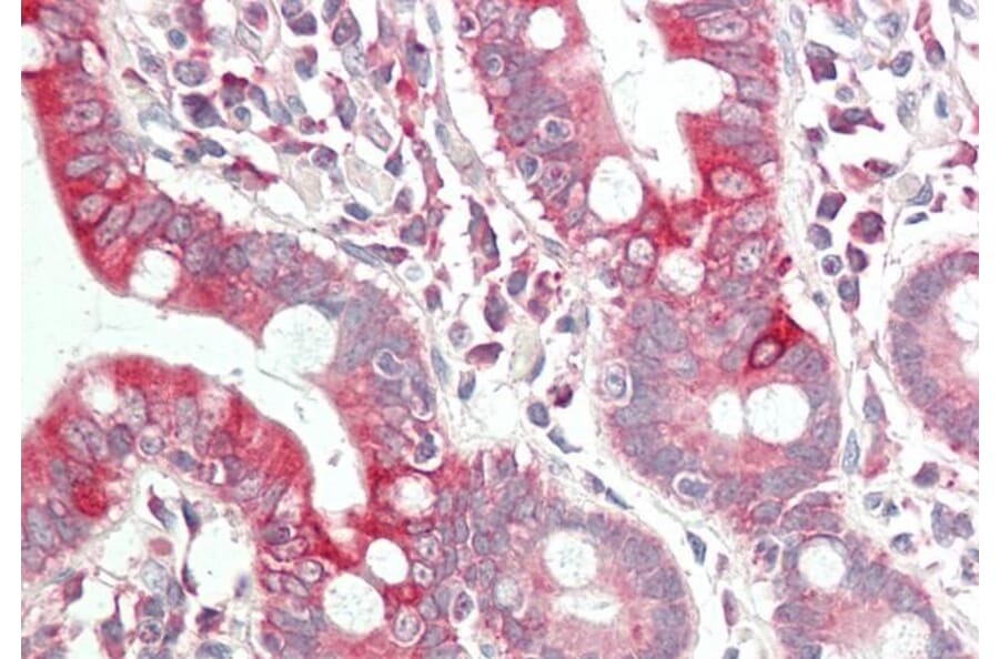 Immunohistochemistry - Anti-VEGFA Antibody (A83043) - Antibodies.com
