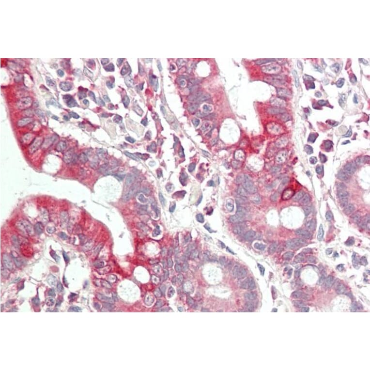 Immunohistochemistry - Anti-VEGFA Antibody (A83043) - Antibodies.com