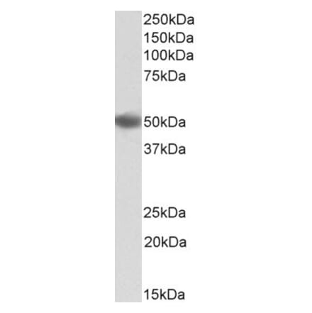 Western Blot - Anti-DC-SIGN Antibody (A83044) - Antibodies.com