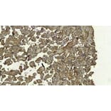 Immunohistochemistry - Anti-DC-SIGN Antibody (A83044) - Antibodies.com