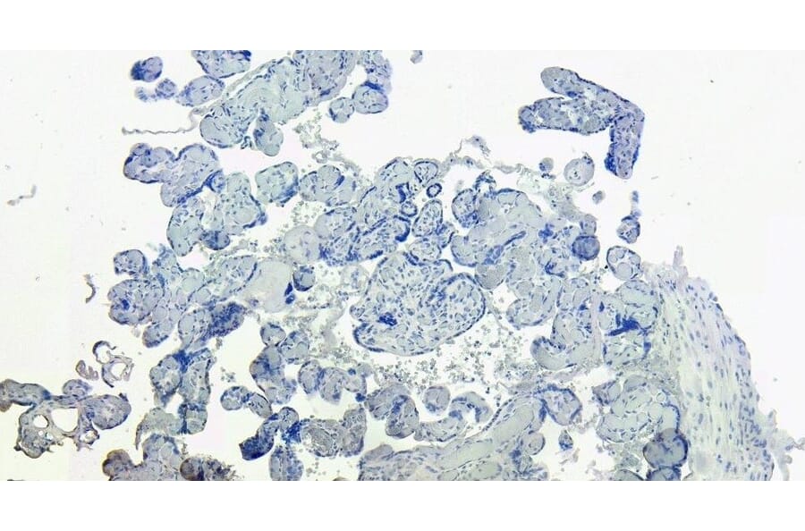 Immunohistochemistry - Anti-DC-SIGN Antibody (A83044) - Antibodies.com