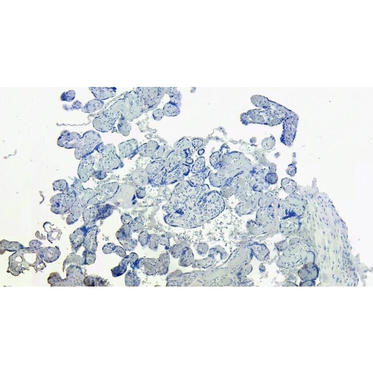 Immunohistochemistry - Anti-DC-SIGN Antibody (A83044) - Antibodies.com