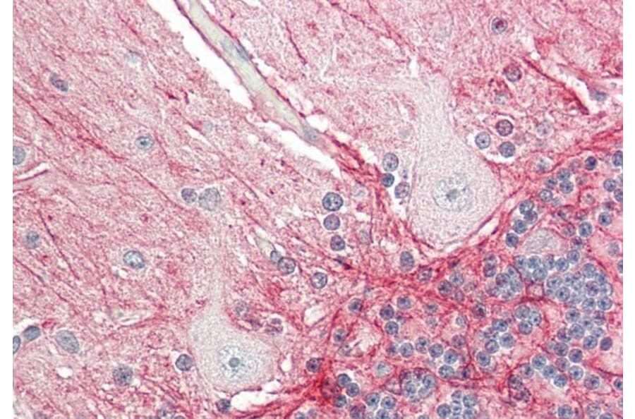 Immunohistochemistry - Anti-Amyloid beta Precursor Protein Antibody (A83045) - Antibodies.com