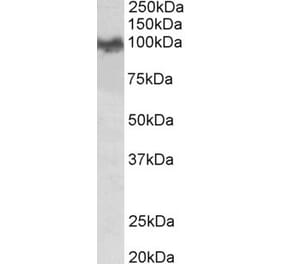 Western Blot - Anti-App Antibody (A83045) - Antibodies.com