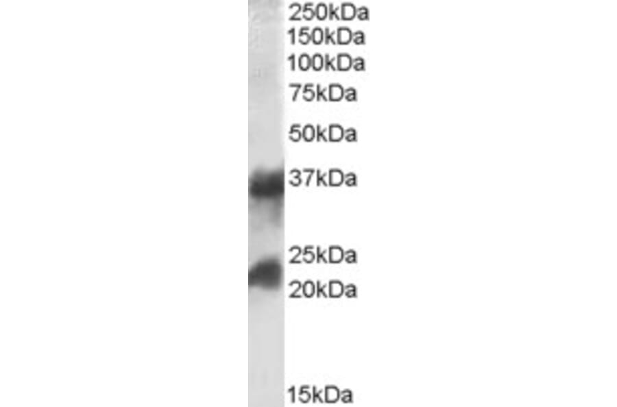 Western Blot - Anti-Clathrin Heavy + Light Chain Antibody (A83046) - Antibodies.com
