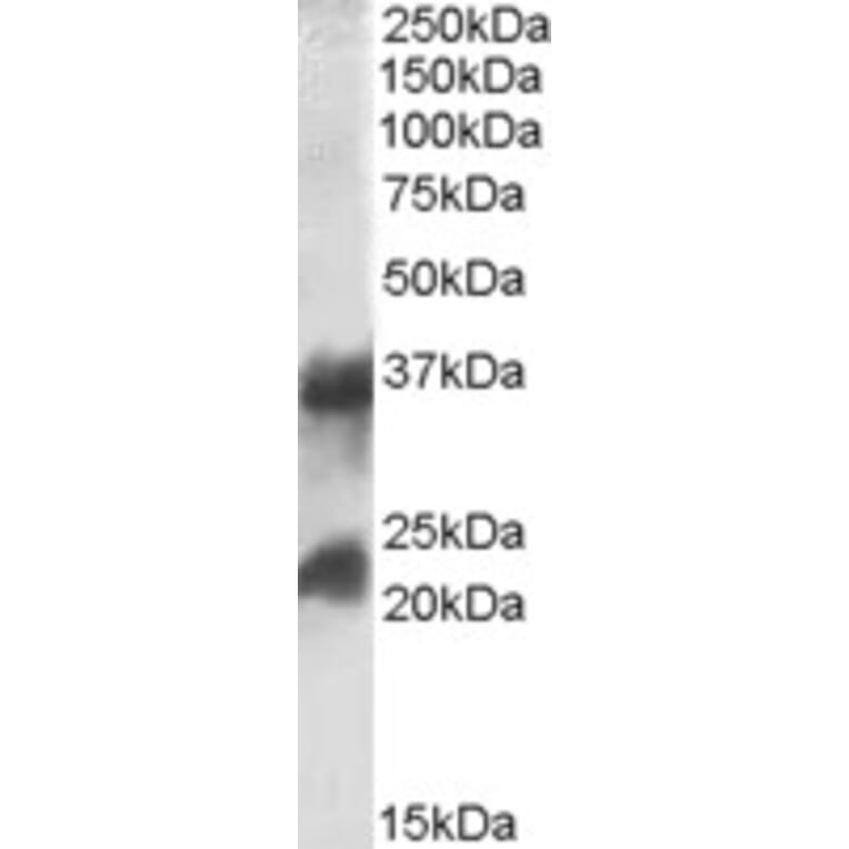 Western Blot - Anti-Clathrin Heavy + Light Chain Antibody (A83046) - Antibodies.com