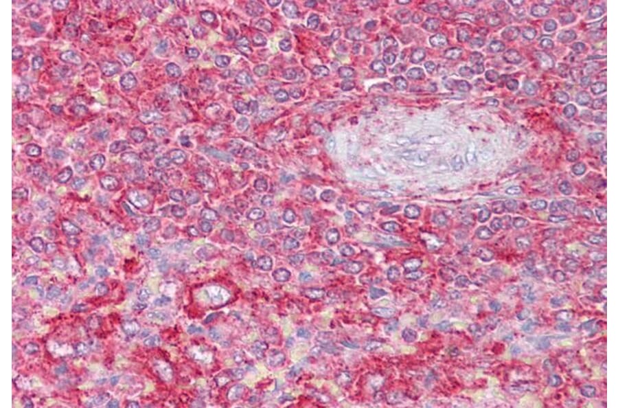 Immunohistochemistry - Anti-Clathrin Heavy + Light Chain Antibody (A83046) - Antibodies.com