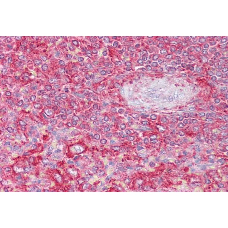 Immunohistochemistry - Anti-Clathrin Heavy + Light Chain Antibody (A83046) - Antibodies.com