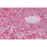 Immunohistochemistry - Anti-Clathrin Heavy + Light Chain Antibody (A83046) - Antibodies.com