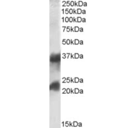 Western Blot - Anti-CLTA Antibody (A83046) - Antibodies.com
