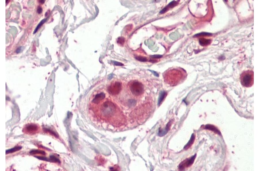 Immunohistochemistry - Anti-Amino-Terminal Enhancer of Split/AES Antibody (A83048) - Antibodies.com