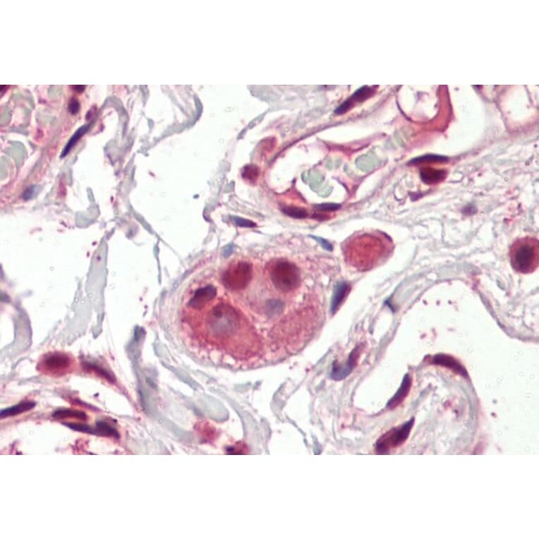 Immunohistochemistry - Anti-Amino-Terminal Enhancer of Split/AES Antibody (A83048) - Antibodies.com