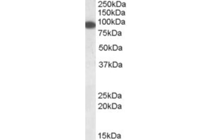 Western Blot - Anti-ELKS Antibody (A83049) - Antibodies.com
