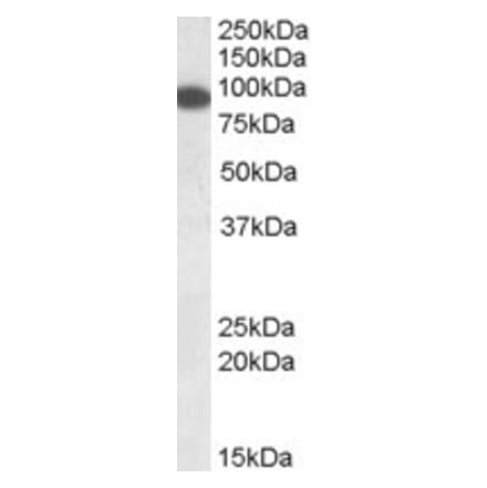 Western Blot - Anti-ELKS Antibody (A83049) - Antibodies.com