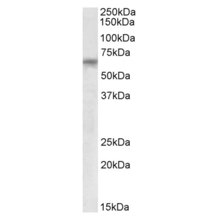 Western Blot - Anti-BBS8 Antibody (A83052) - Antibodies.com