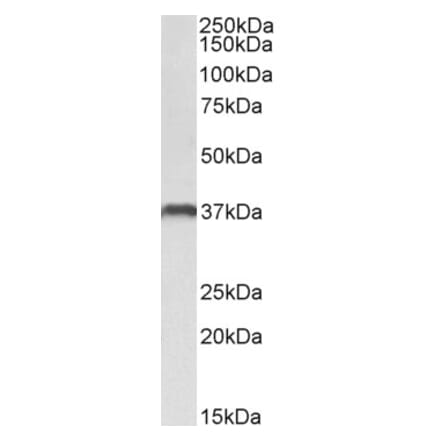 Western Blot - Anti-CLEC12A Antibody (A83053) - Antibodies.com
