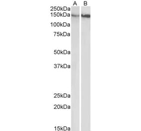 Western Blot - Anti-Integrin beta 1 Antibody (A83054) - Antibodies.com