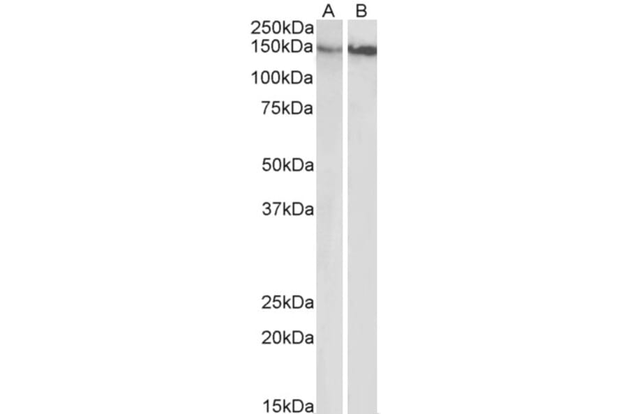 Western Blot - Anti-Integrin beta 1 Antibody (A83054) - Antibodies.com
