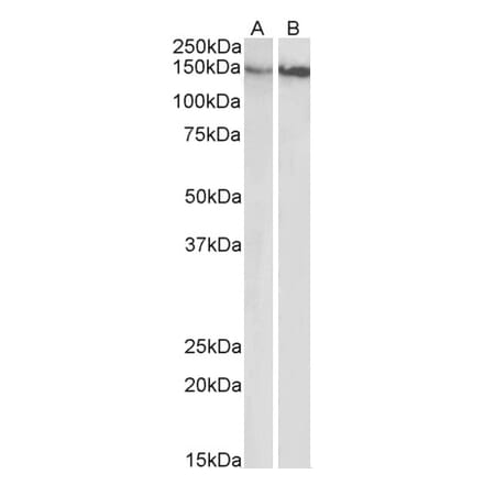 Western Blot - Anti-Integrin beta 1 Antibody (A83054) - Antibodies.com