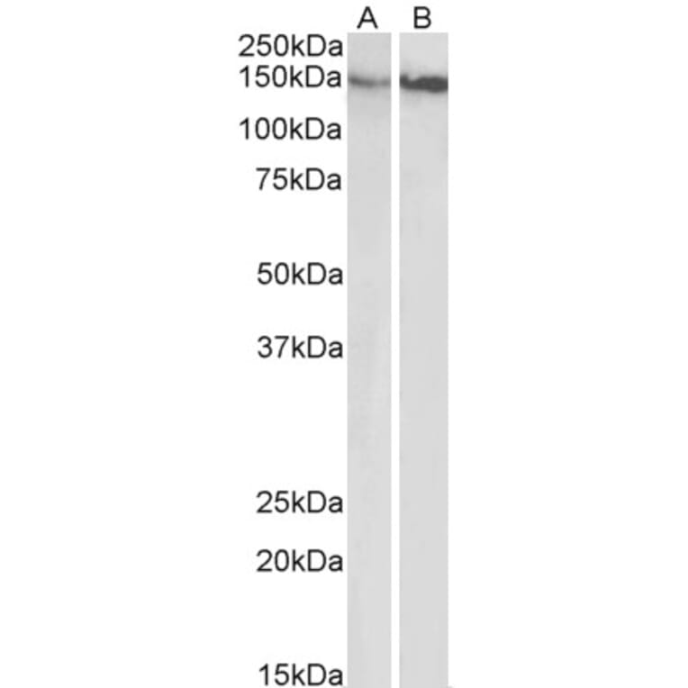 Western Blot - Anti-Integrin beta 1 Antibody (A83054) - Antibodies.com