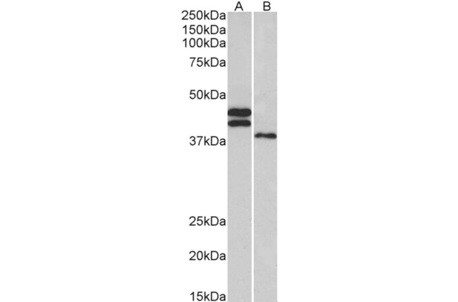 Western Blot - Anti-FCRL1 Antibody (A83055) - Antibodies.com