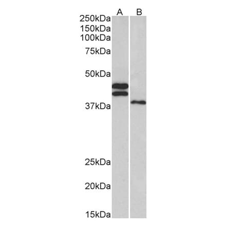 Western Blot - Anti-FCRL1 Antibody (A83055) - Antibodies.com