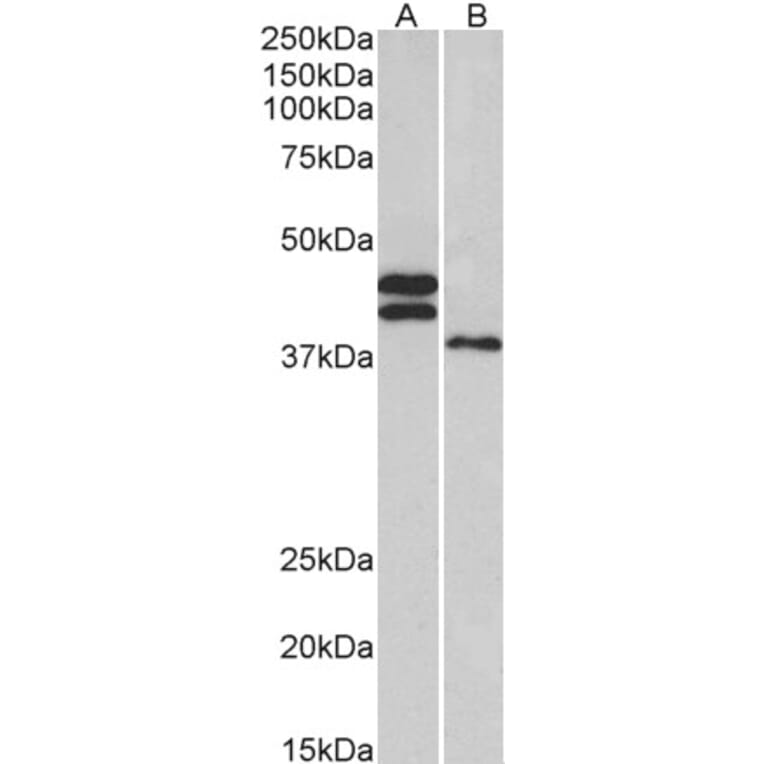 Western Blot - Anti-FCRL1 Antibody (A83055) - Antibodies.com
