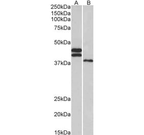 Western Blot - Anti-FCRL1 Antibody (A83055) - Antibodies.com