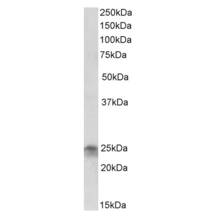 Western Blot - Anti-FGF8 Antibody (A83057) - Antibodies.com