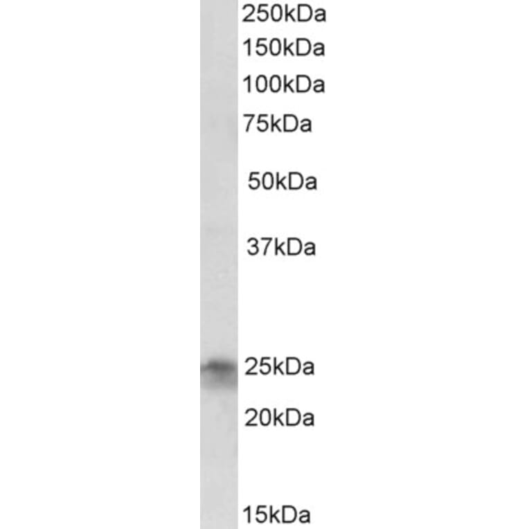 Western Blot - Anti-FGF8 Antibody (A83057) - Antibodies.com