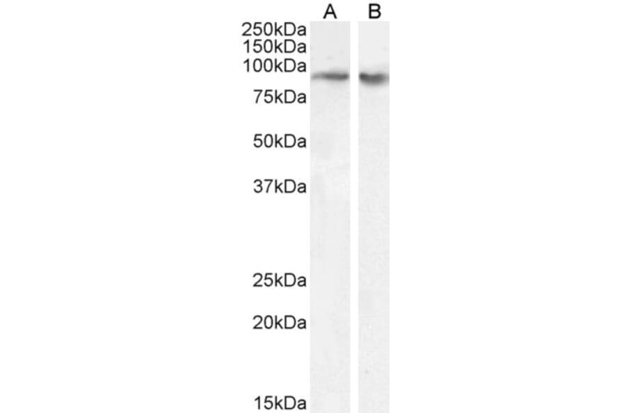 Western Blot - Anti-FBXO11 Antibody (A83058) - Antibodies.com