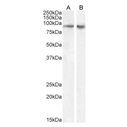 Western Blot - Anti-FBXO11 Antibody (A83058) - Antibodies.com