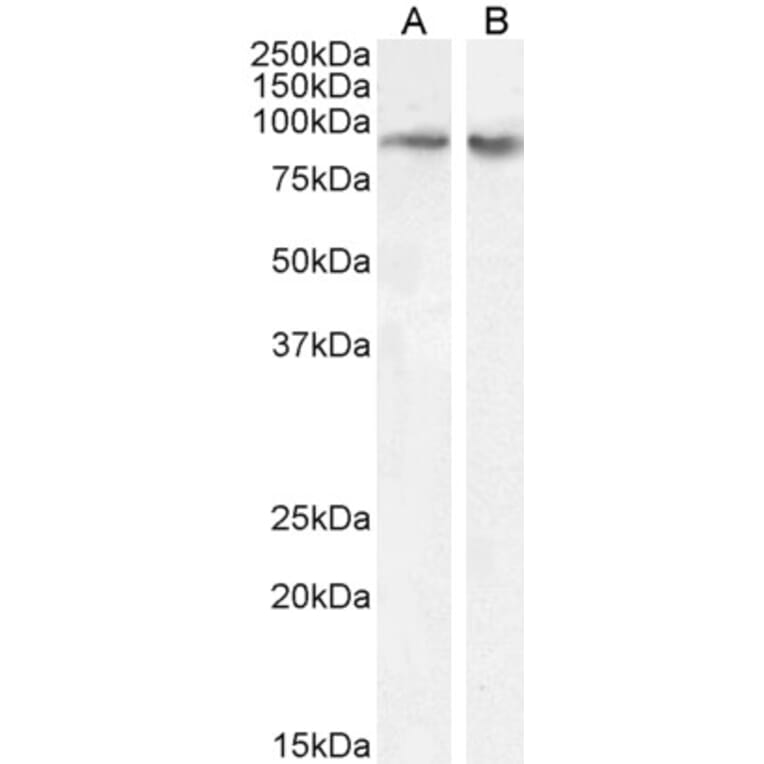 Western Blot - Anti-FBXO11 Antibody (A83058) - Antibodies.com