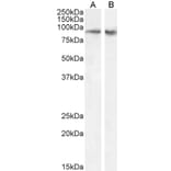 Western Blot - Anti-FBXO11 Antibody (A83058) - Antibodies.com
