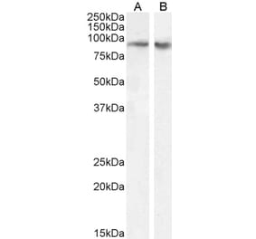 Western Blot - Anti-FBXO11 Antibody (A83058) - Antibodies.com