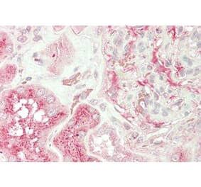 Immunohistochemistry - Anti-UNC13B Antibody (A83060) - Antibodies.com