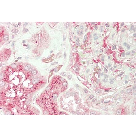 Immunohistochemistry - Anti-UNC13B Antibody (A83060) - Antibodies.com