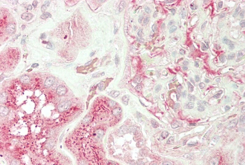 Anti-Unc13b Antibody (A83060) (5µg/ml) staining of paraffin embedded Human Kidney. Steamed antigen retrieval with citrate buffer pH 6, AP-staining.