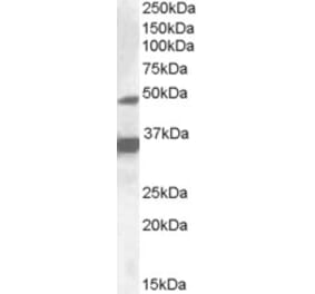 Western Blot - Anti-PXR Antibody (A83061) - Antibodies.com