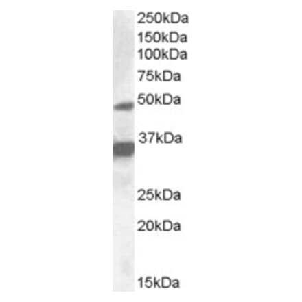 Western Blot - Anti-PXR Antibody (A83061) - Antibodies.com