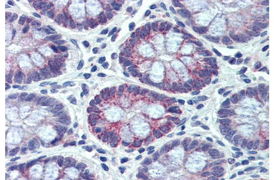 Immunohistochemistry - Anti-PXR Antibody (A83061) - Antibodies.com