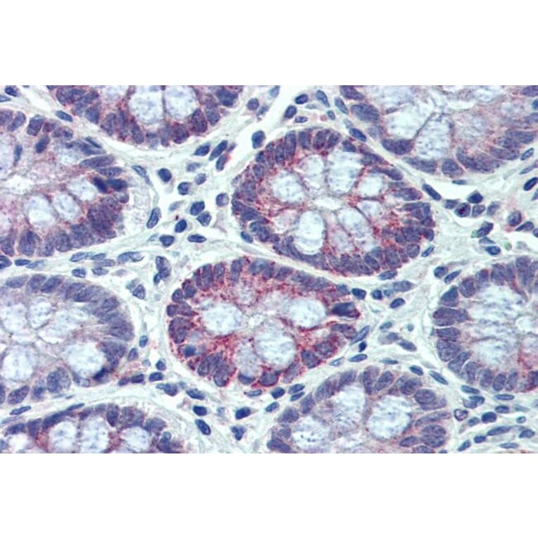 Immunohistochemistry - Anti-PXR Antibody (A83061) - Antibodies.com