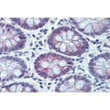 Immunohistochemistry - Anti-PXR Antibody (A83061) - Antibodies.com