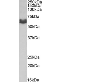 Western Blot - Anti-AMHR2 Antibody (A83062) - Antibodies.com