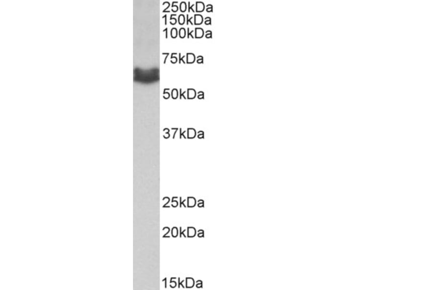 Western Blot - Anti-AMHR2 Antibody (A83062) - Antibodies.com
