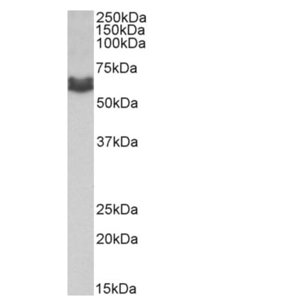 Western Blot - Anti-AMHR2 Antibody (A83062) - Antibodies.com
