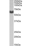 Western Blot - Anti-AMHR2 Antibody (A83062) - Antibodies.com